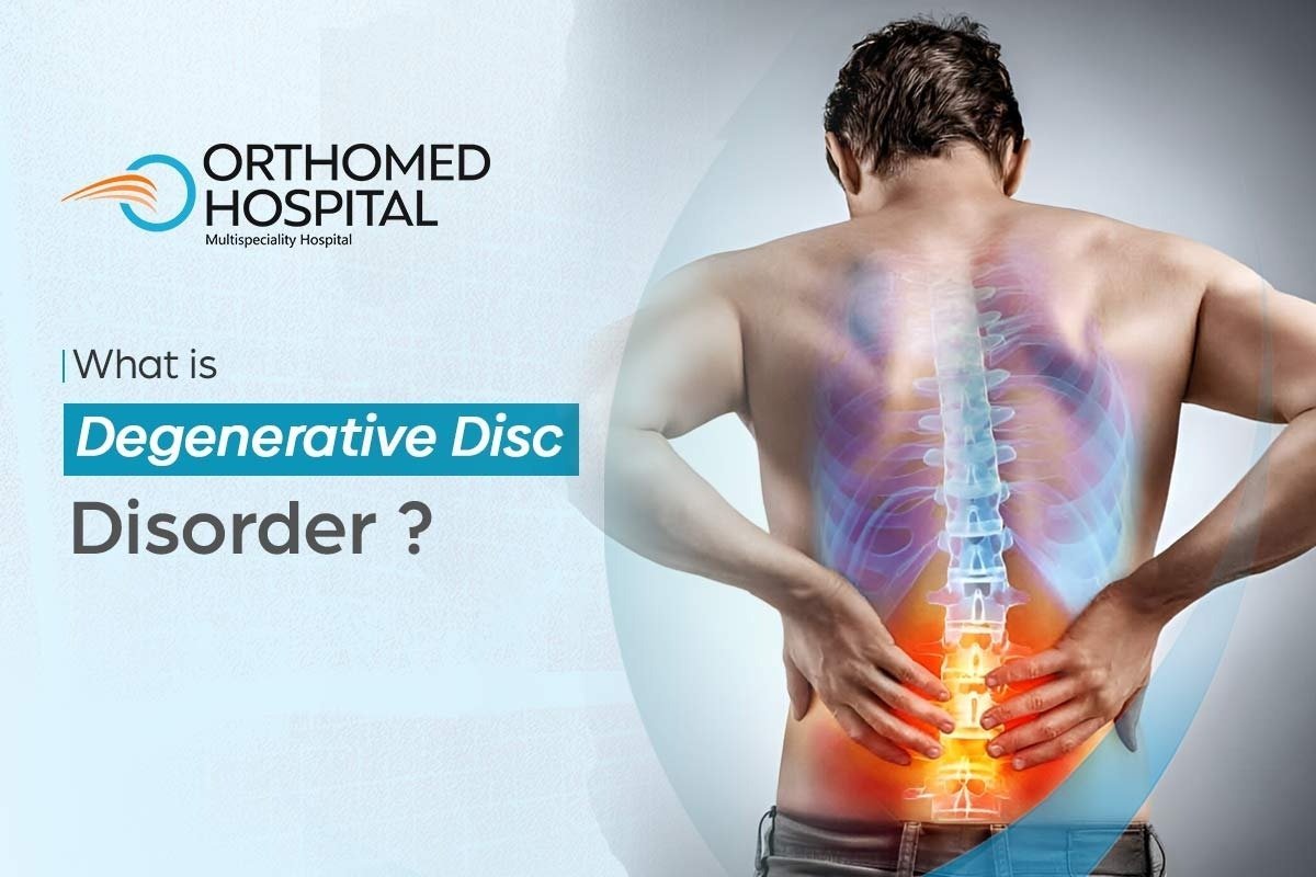 Understanding Degenerative Disc Disorder: A Comprehensive Guide