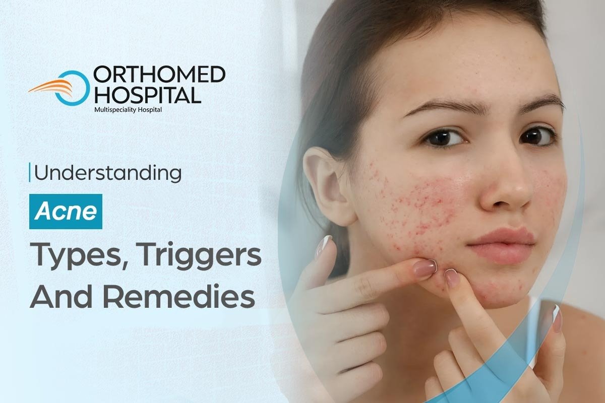 Understanding Acne Types, Triggers, and Remedies.